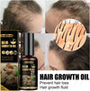 South Moon Ginger Hair Growth Oil – 50ml