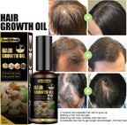 South Moon Ginger Hair Growth Oil – 50ml
