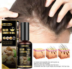 South Moon Ginger Hair Growth Oil – 50ml
