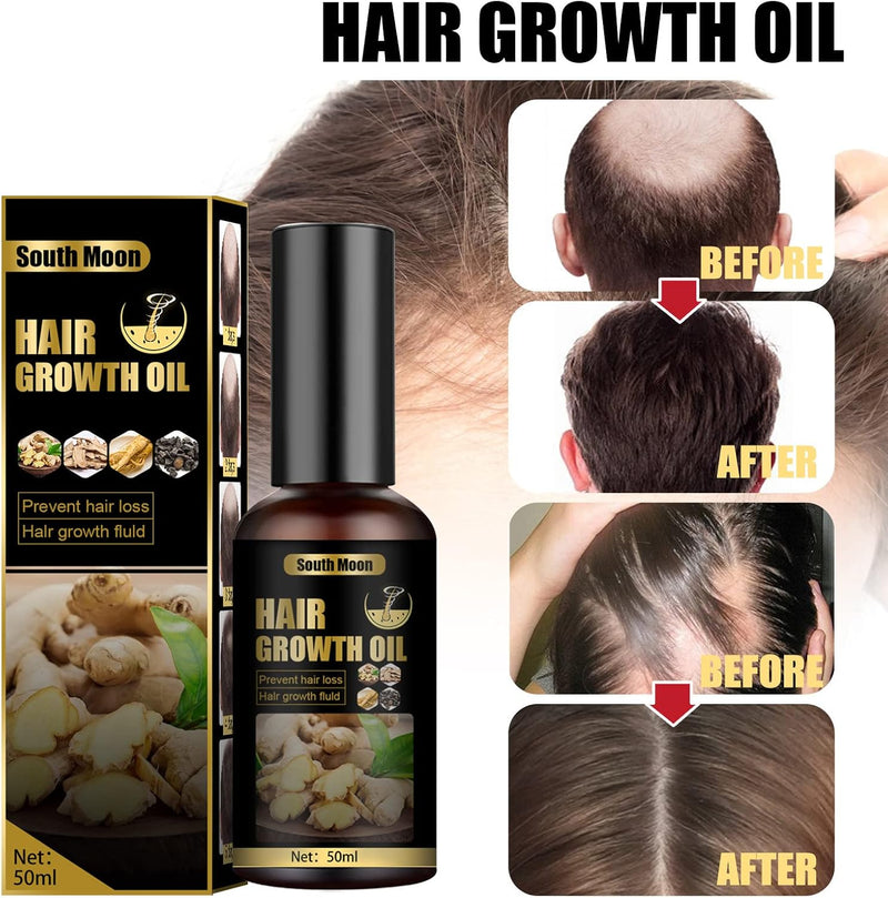 South Moon Ginger Hair Growth Oil – 50ml