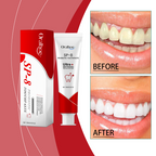 Oralhoe SP-8 Probiotic Toothpaste – Advanced Daily Oral Care