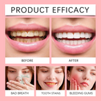 Oralhoe SP-8 Probiotic Toothpaste – Advanced Daily Oral Care