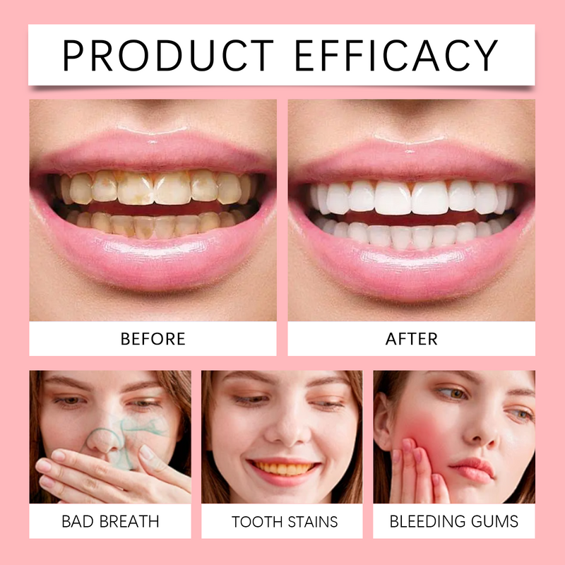 Oralhoe SP-8 Probiotic Toothpaste – Advanced Daily Oral Care